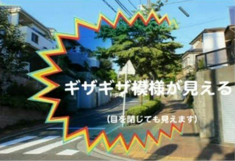 突然視界に赤青緑のギザギザ 偏頭痛の予兆 閃輝暗点 って 渕上真希 フチガミマキ Note