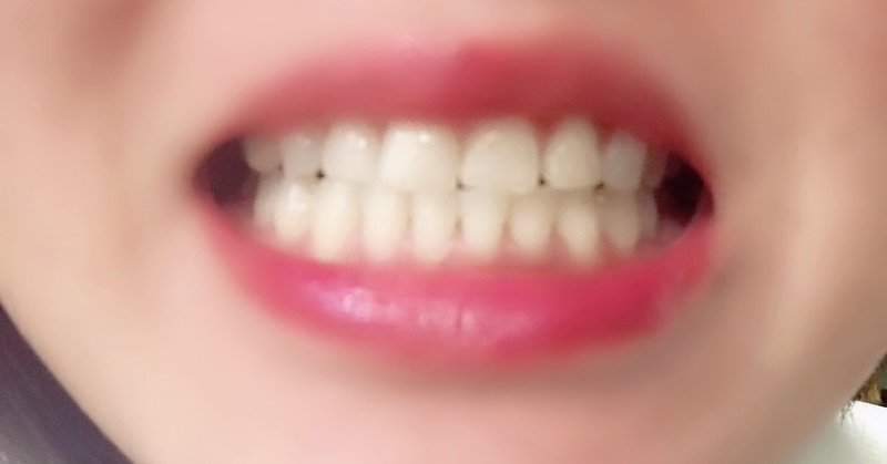 アラフォー歯を白くしたい！効果のあるホワイトニングはこれだ！！自宅で出来る歯のホワイトニング