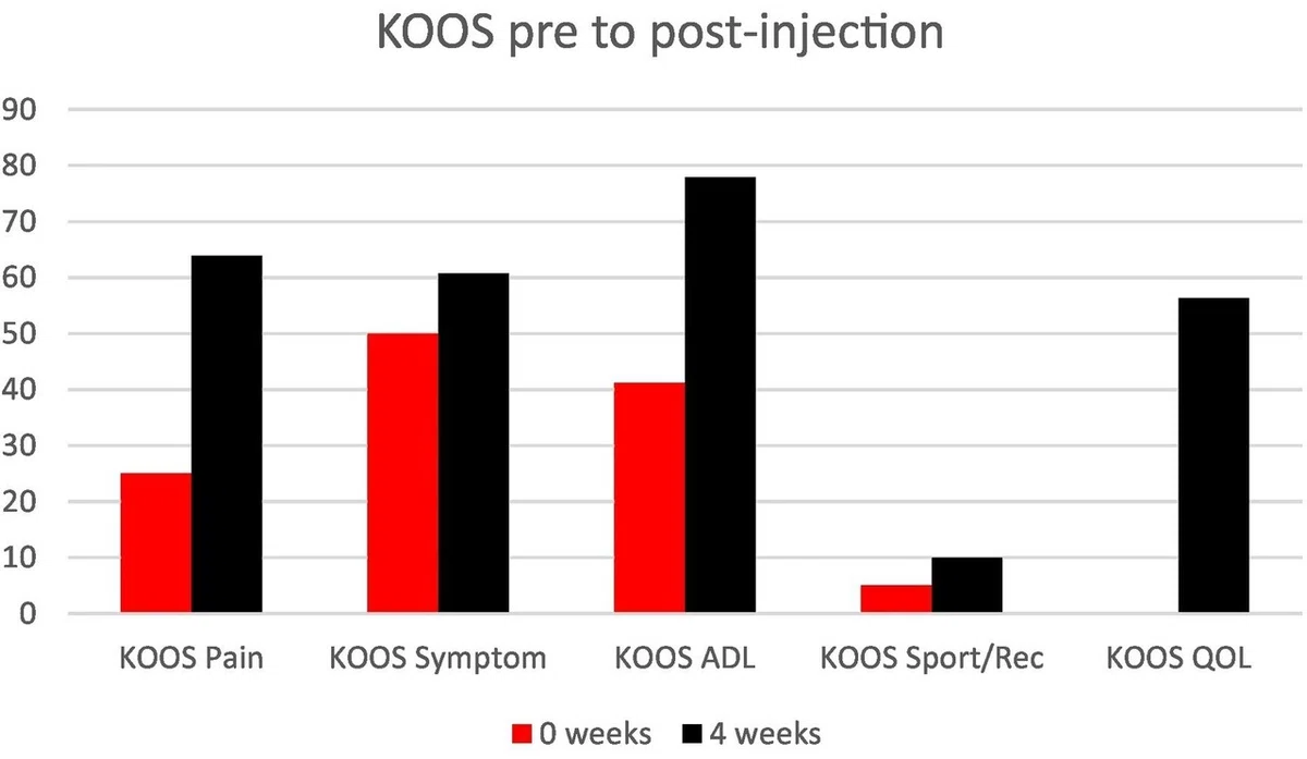 Botulinum toxin for knee OA!?｜Super Human | 理学療法士／保健学博士 Ph.D.