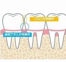 ダウンロード