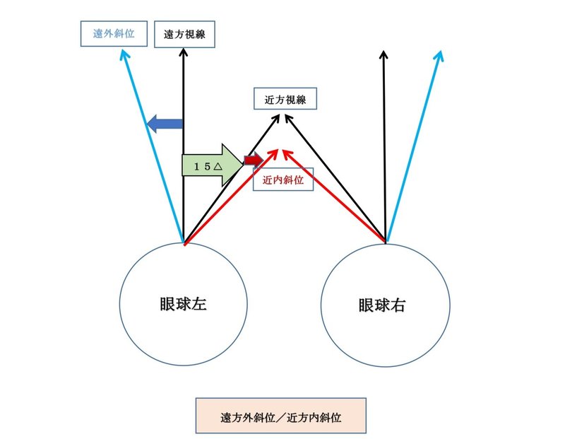 外・内