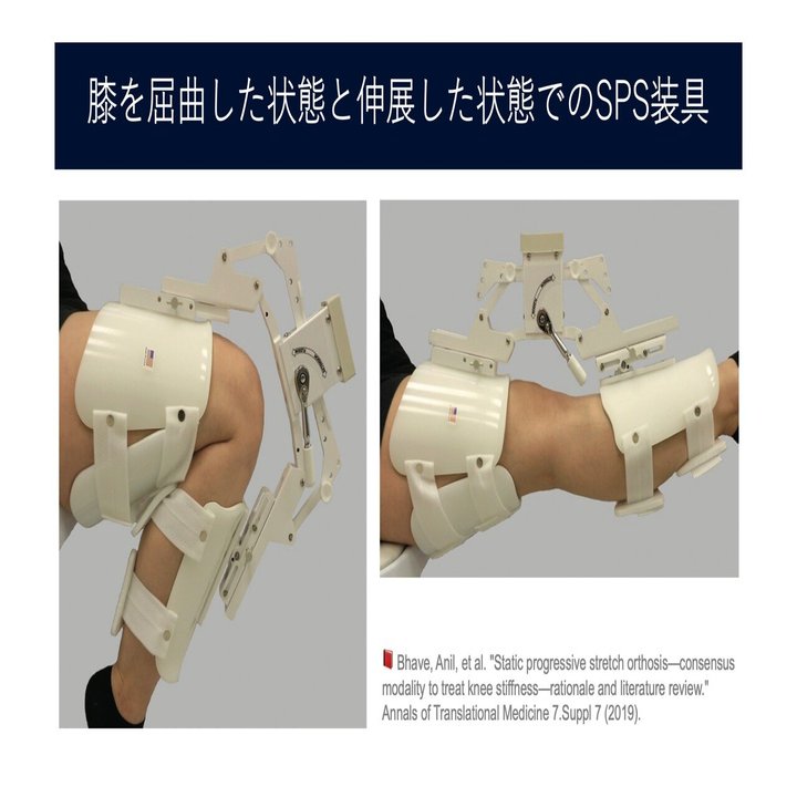 【即戦力】即座に臨床に活かせる！股関節の評価と改善 静的漸進的ストレッチ（SCS）が関節拘縮を防ぐ。30分間で関節包