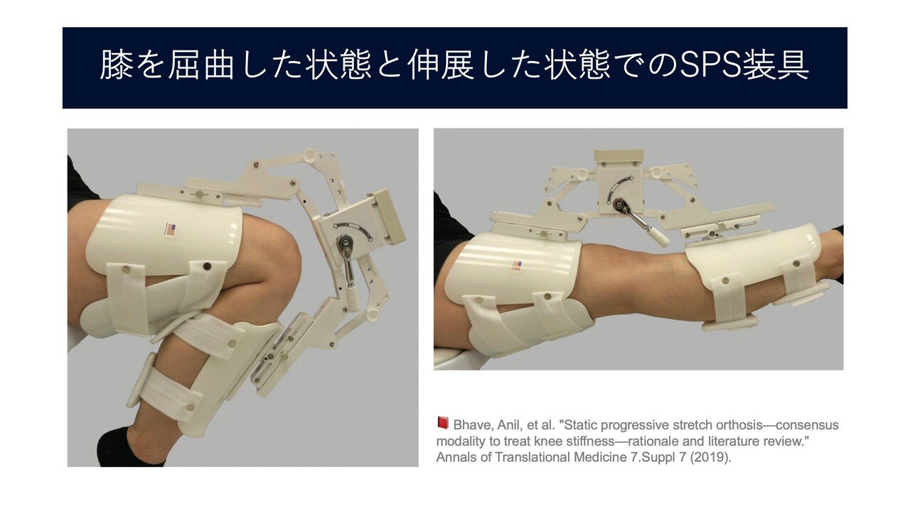 静的漸進的ストレッチ(SCS)が関節拘縮を防ぐ。30分間で関節包 静的漸進的ストレッチ(SCS)が関節拘縮を防ぐ。30分間で関節包