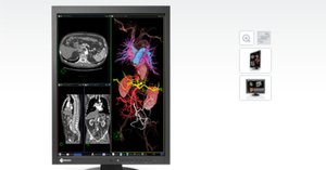 K様線　EIZO RadiForce MX215 医療用 モニター2台セット K様線 EIZO RadiForce MX215 医療用 モニター2台セット - メルカリ