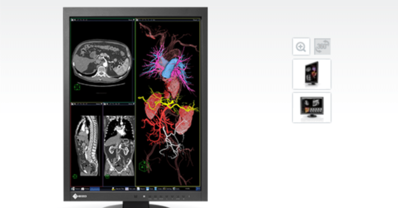 EIZO RadiForce MX215液晶モニター/ DVI/B5-MX215