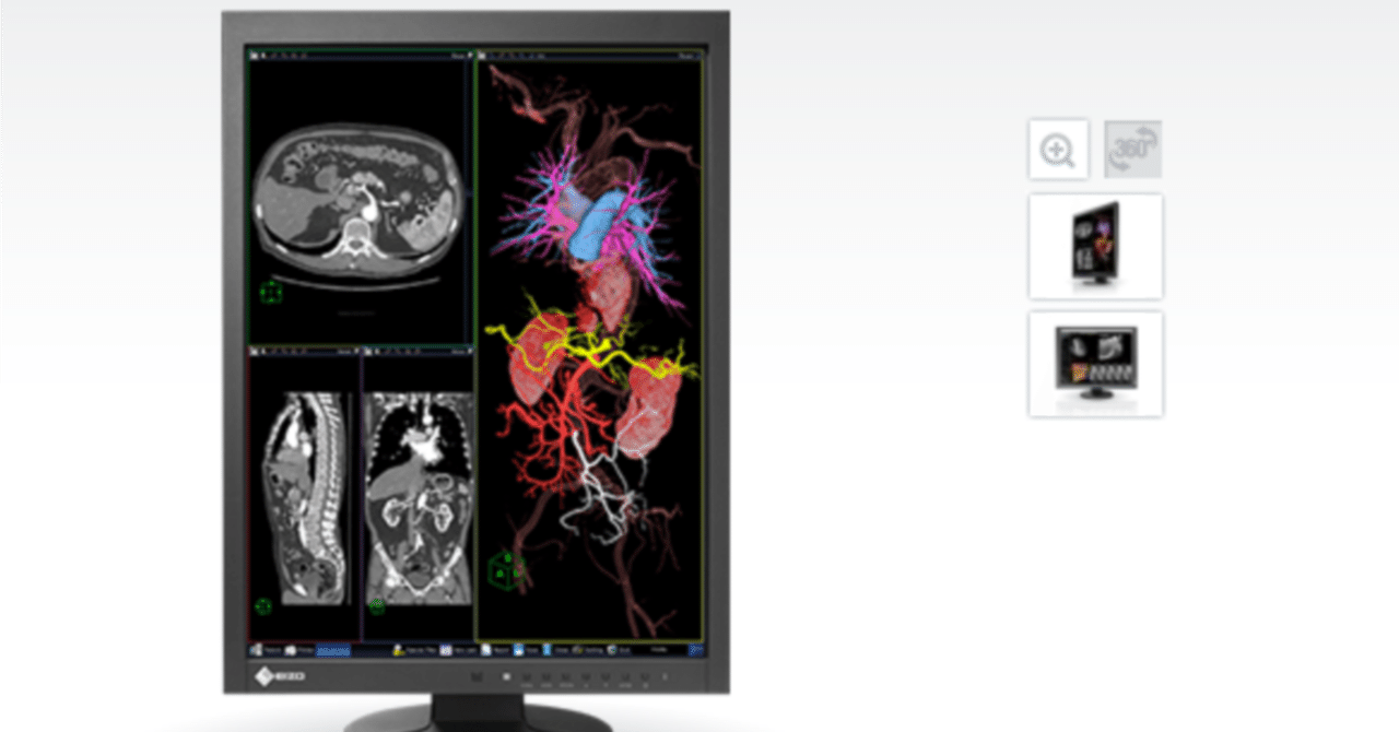 EIZO MX215-BK ブラック ディスプレイ本体 Amazon.co.jp: EIZO MX215-BK RadiForce 21.3'' LED-Backlit LCD