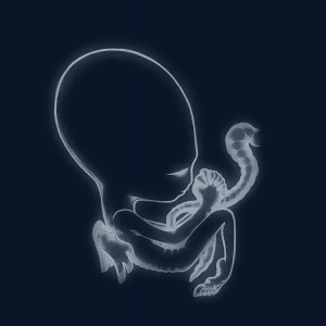 Sigur Rós(シガー・ロス)全アルバム聴いてみた｜畑中修介