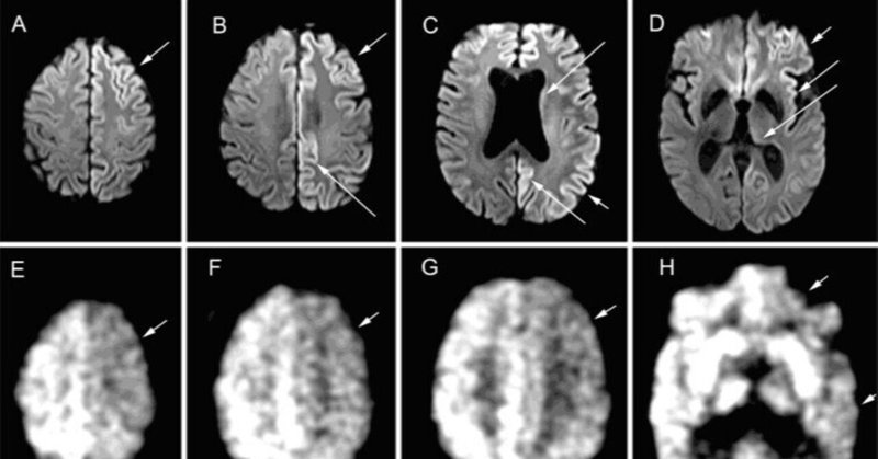 脳とプリオン―狂牛病の分子生物学 (シリーズ・応用動物科学バイオサイエンス) [単行本] 節，小野寺; 圭一，佐伯 脳とプリオン: 狂牛病の分子生物学 (シリーズ応用動物科学