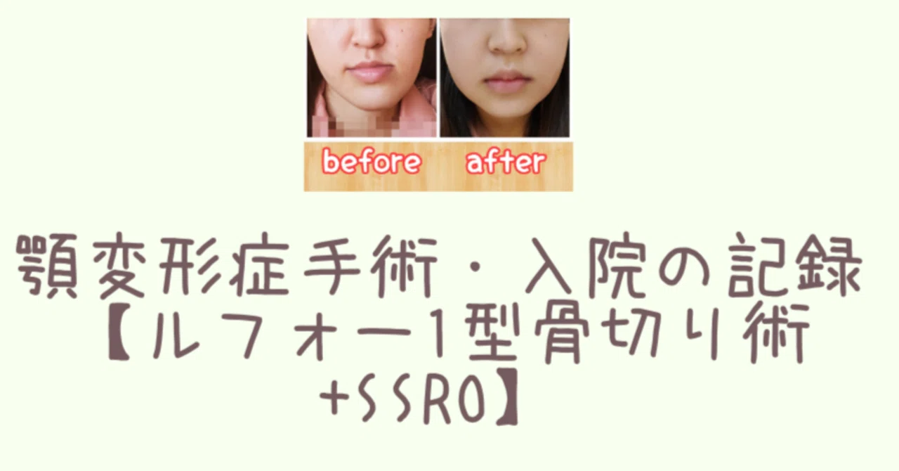 顎変形症手術・入院の記録【ルフォー1型骨切り術+SSRO】|木部夏生(囲碁棋士)