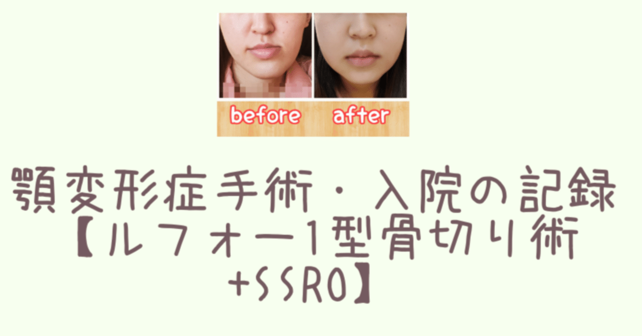 顎変形症手術・入院の記録【ルフォー1型骨切り術+SSRO】｜木部夏生