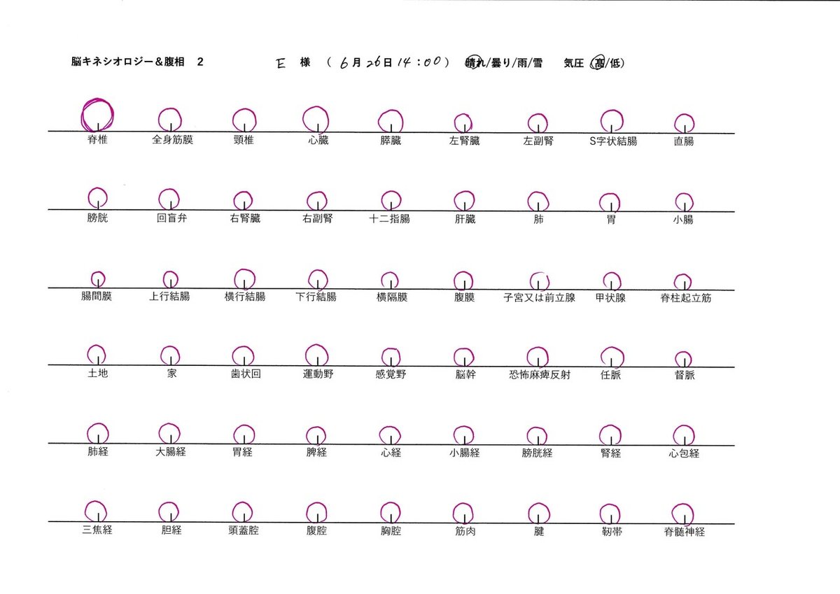 e様脳キネ腹相2ビフォー