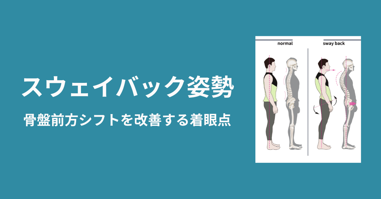 スウェイバックはどのように治療されますか?