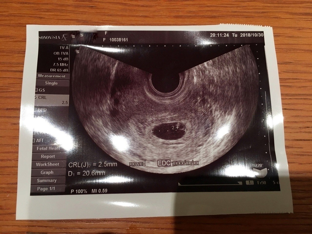 10 30 妊娠発覚 25歳塩尻移住 妊娠6週目 Note