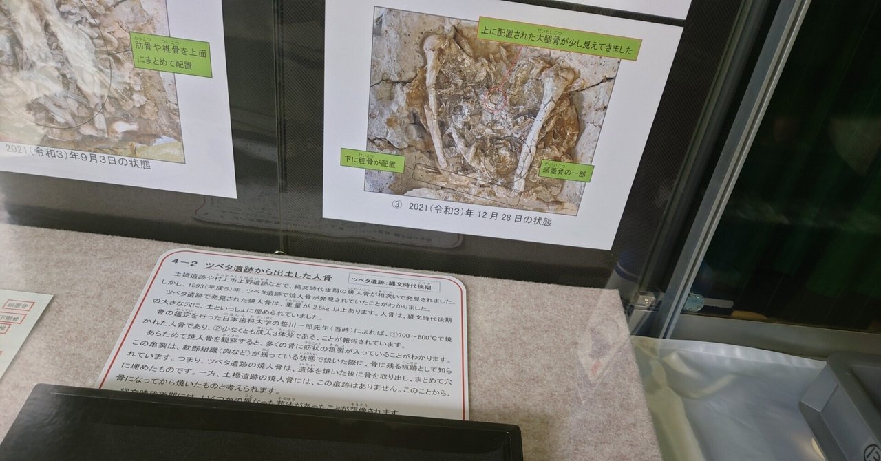 新潟県で大注目!!縄文人の骨