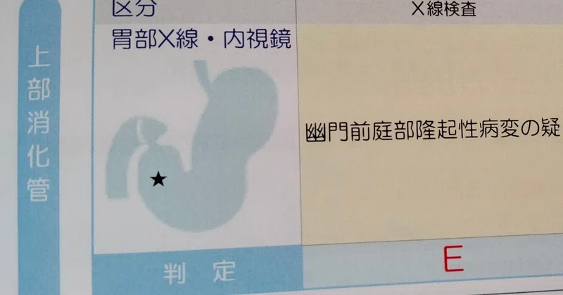 幽門前庭部隆起性病変(疑)|*Ⅲơ₃ơⅢ*栗英田テツヲ|note