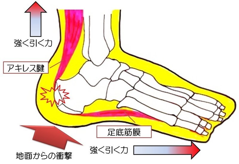 かかとの痛み シーバー病対策 アヤコ先生 世界一わかりやすく最新ヒット曲振り付け解説youtuber Note かかとの痛み シーバー病対策 アヤコ先生 世界一わかりやすく最新ヒット曲振り付け解説youtuber Note