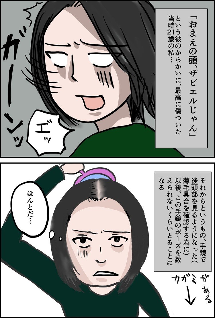 アラサーの切実な悩み 薄毛女性 とろサバ Note アラサーの切実な悩み 薄毛女性 とろサバ Note