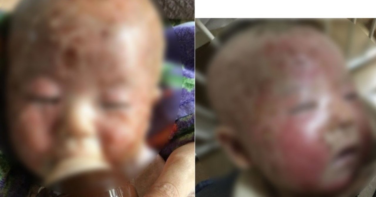 自然派ママをバカにし過ぎると ﾐﾗｸﾙみちる Note