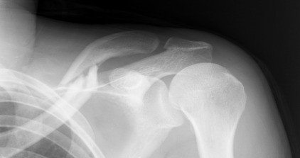 全ライダー必読 バイク自損事故を End To End でまとめてみた 救急搬送から保険金請求まで はなだて Note 全ライダー必読 バイク自損事故を End To End でまとめてみた 救急搬送から保険金請求まで はなだて Note