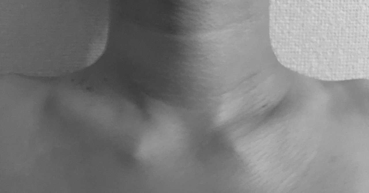 鎖骨の角度が Vネック のようになっている原因 今村龍之 Tatsuyuki Imamura Note