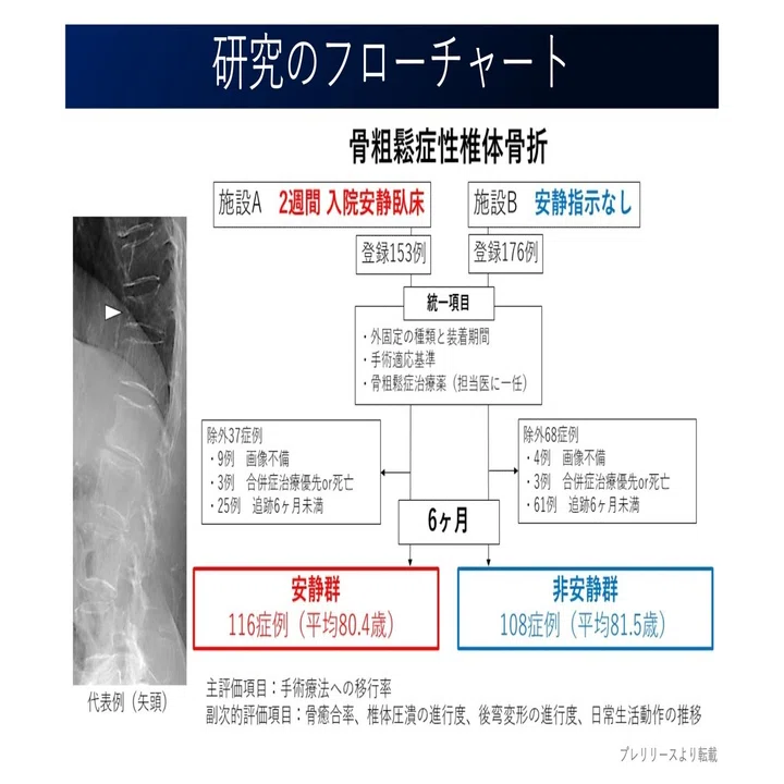 椎体骨折の安静日数。3日 or 14日？｜Super Human | 理学療法士／保健