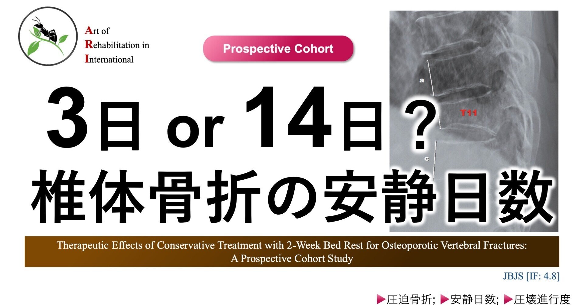椎体骨折の安静日数。3日 or 14日?|Super Human | 理学療法士 椎体骨折の安静日数。3日 or 14日?|Super Human | 理学療法士