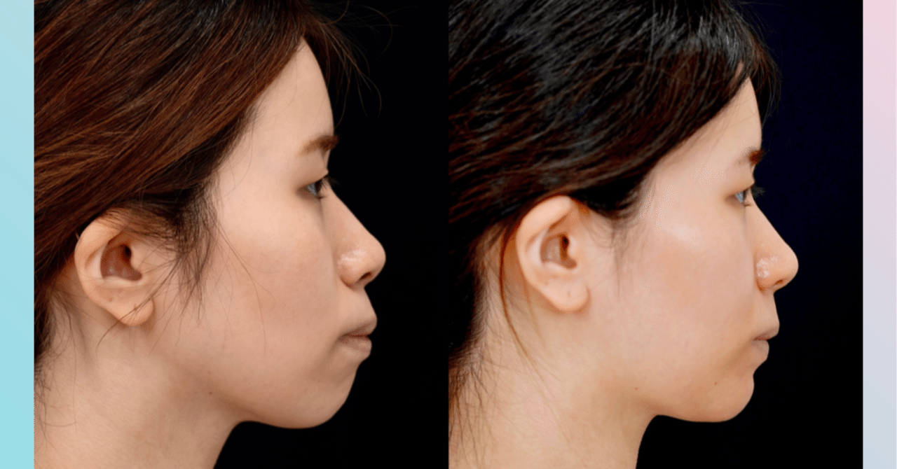 リスクと副作用