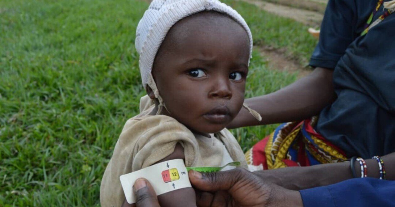 飢餓や栄養不良をめぐる世界の現状 Table For Two 公式 Note 飢餓や栄養不良をめぐる世界の現状 Table For Two 公式 Note
