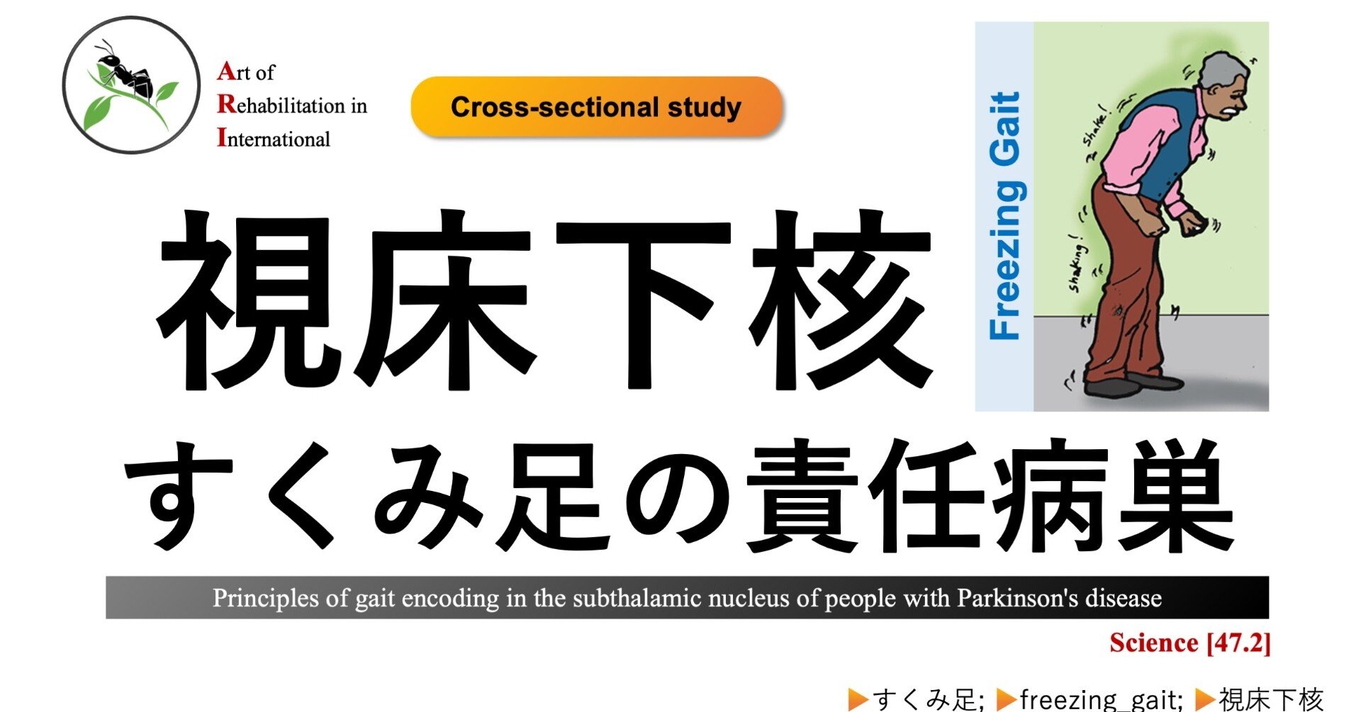 視床下核。すくみ足の責任病巣｜Super Human | 理学療法士／保健