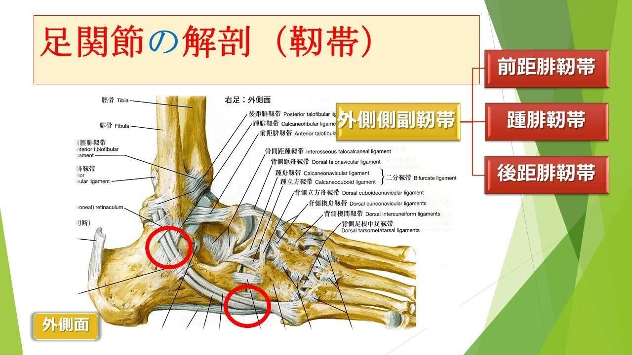 足の外側からの解剖です。外側の靱帯と、長・短腓骨筋腱が走行しています。赤い〇の部分は癒着しやすい部分で、滑走障害が起きる場所です。 外果側 ...