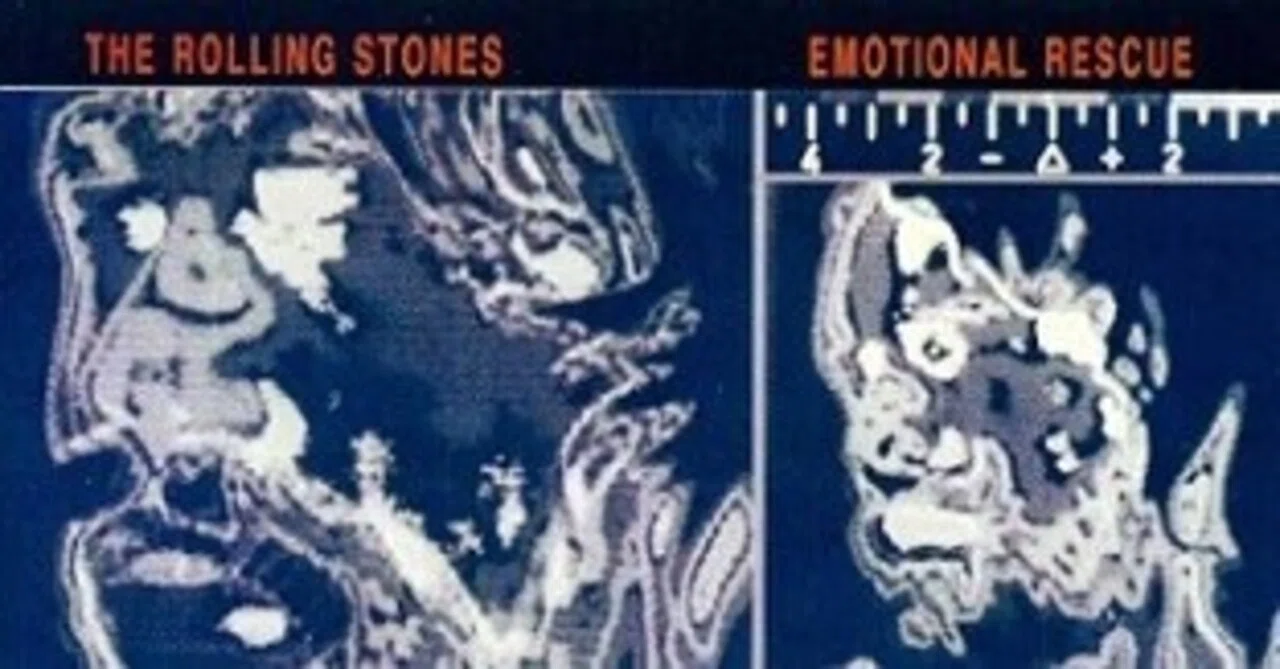 Rolling Stones「Emotional Rescue」(1980)｜音楽の杜