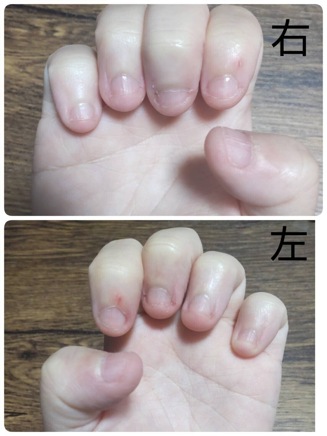 Abht5rgckygqam Abht5rgckygqam