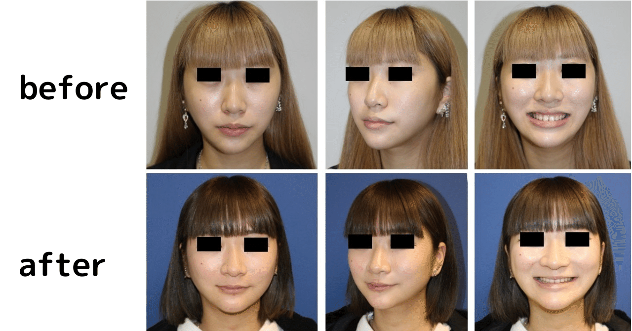 童顔になりたいを叶えます しらゆりビューティークリニック院長伊藤孝明 Note