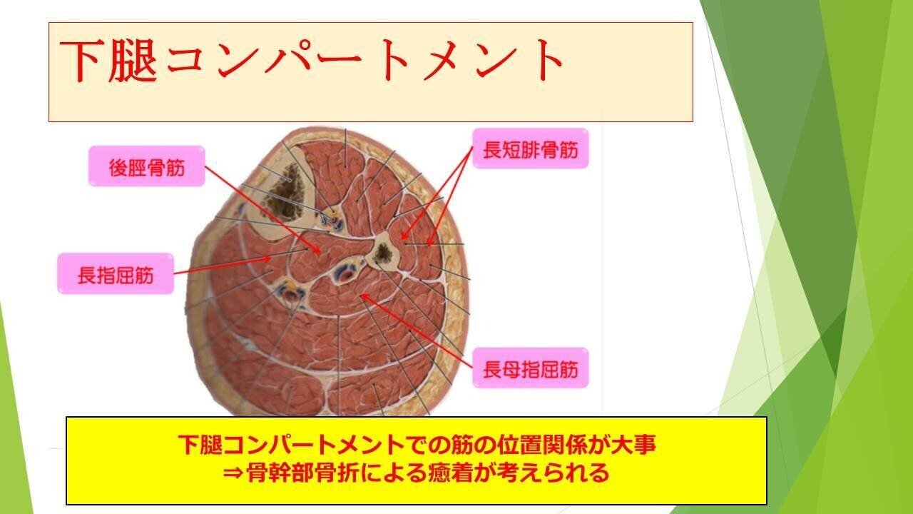 腹部コンパートメント症候群の原因