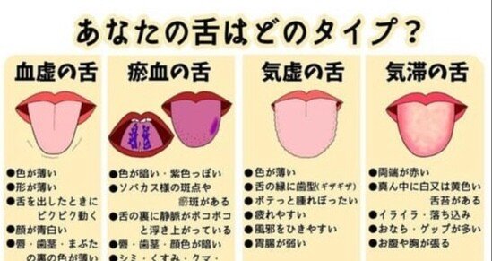 舌診論