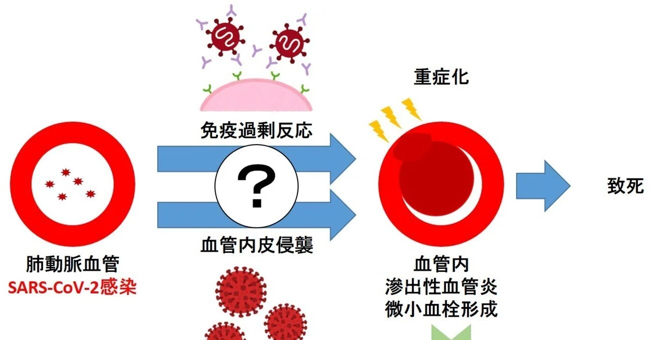 SARS-CoV-2誘発肺滲出性血管炎におけるMyl9の上昇はMyl9を含む微小血栓を反映し、COVID-19の重症度を予見する｜Wit ...