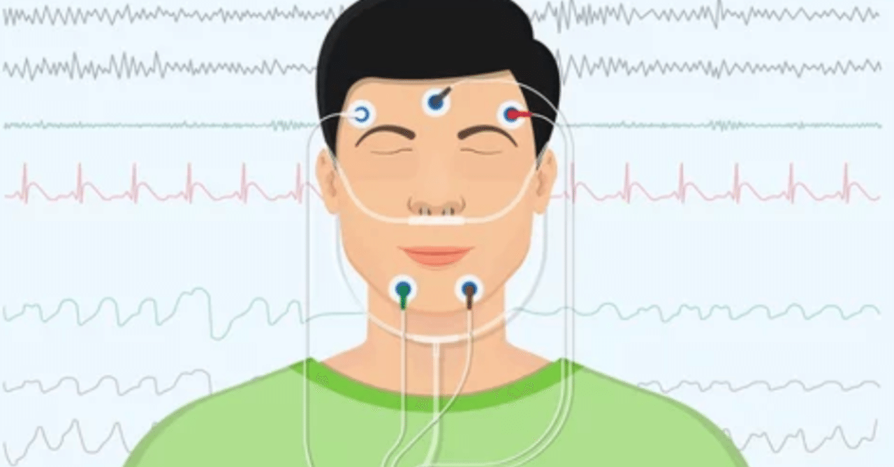 複数睡眠潜時テストによる睡眠潜時測定