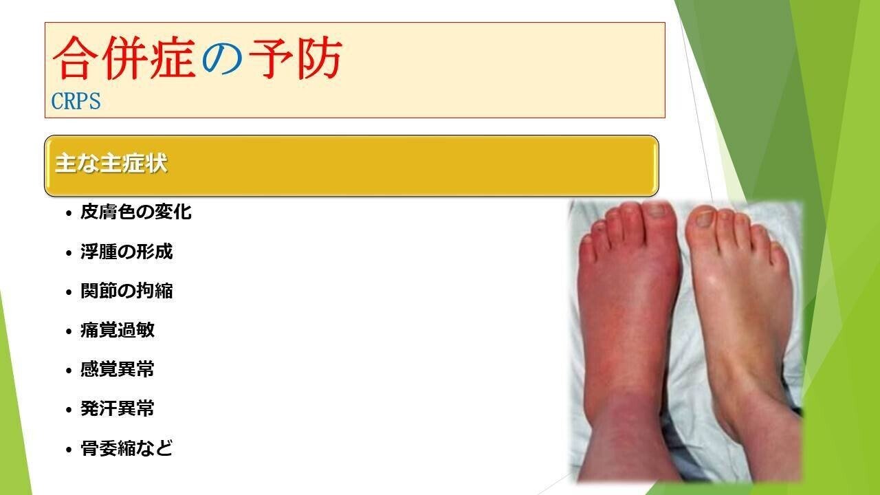 骨折合併症 白熱講義 骨折合併症 Nonunion, Malunion, FRI, PTOA−骨折治療