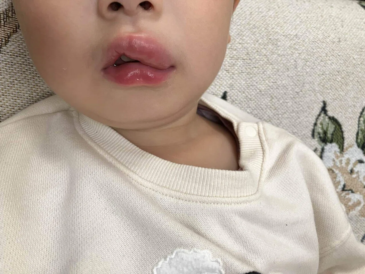 死後硬直の写真