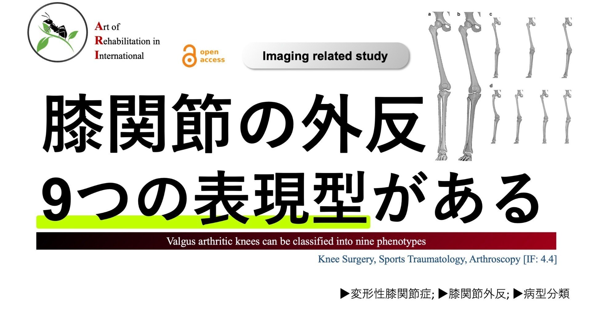 予約販売】膝関節周辺の筋肉の構造 - 京都科学オンラインショップ