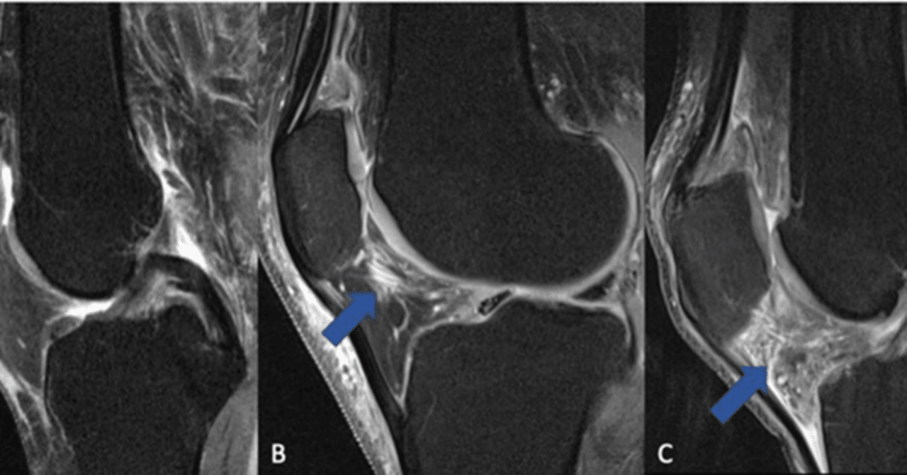 プラセボとは何ですか?