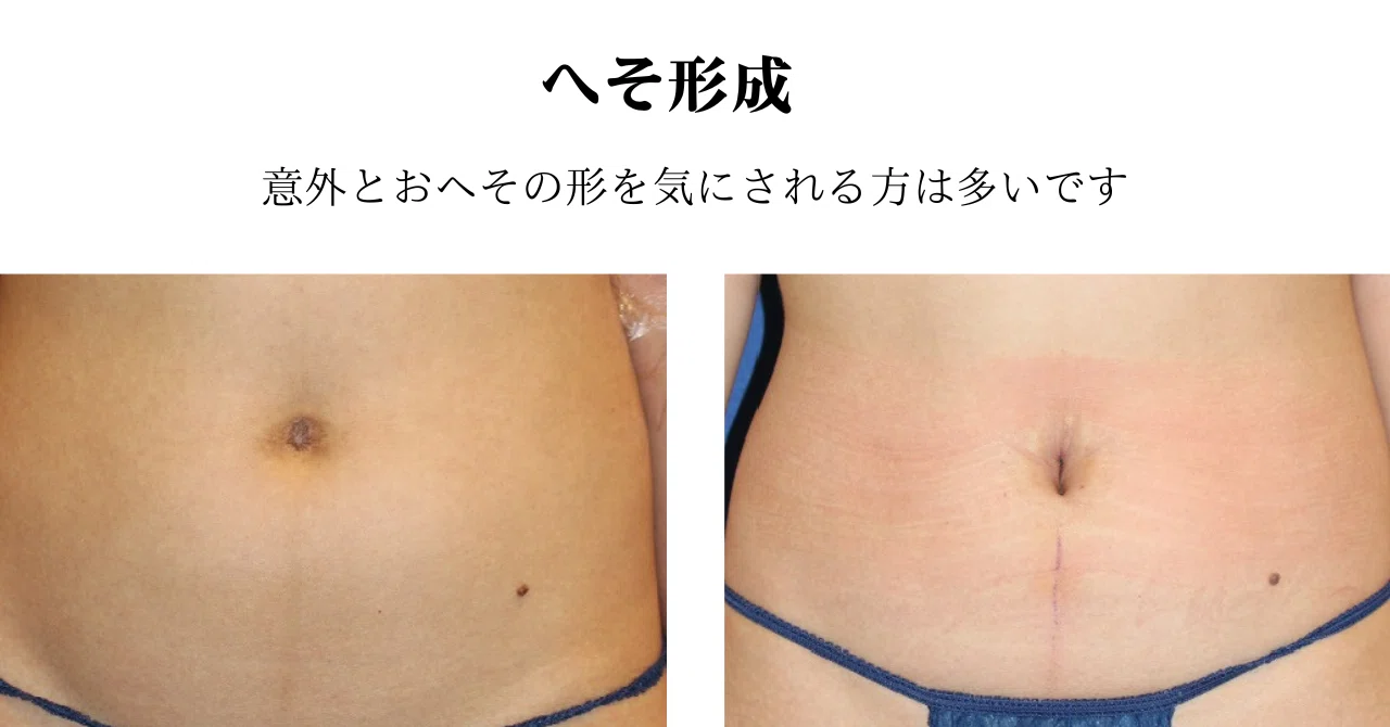 おへそ の 形