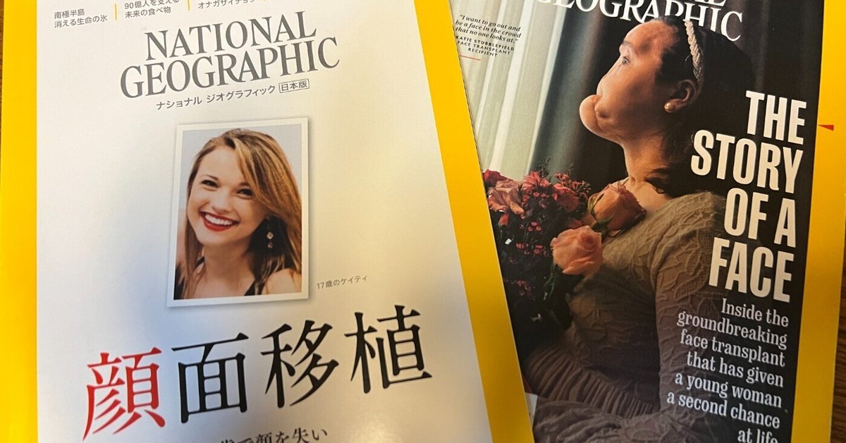 顔面移植」をうけた21歳の女性が提起する数々の課題｜形成外科医