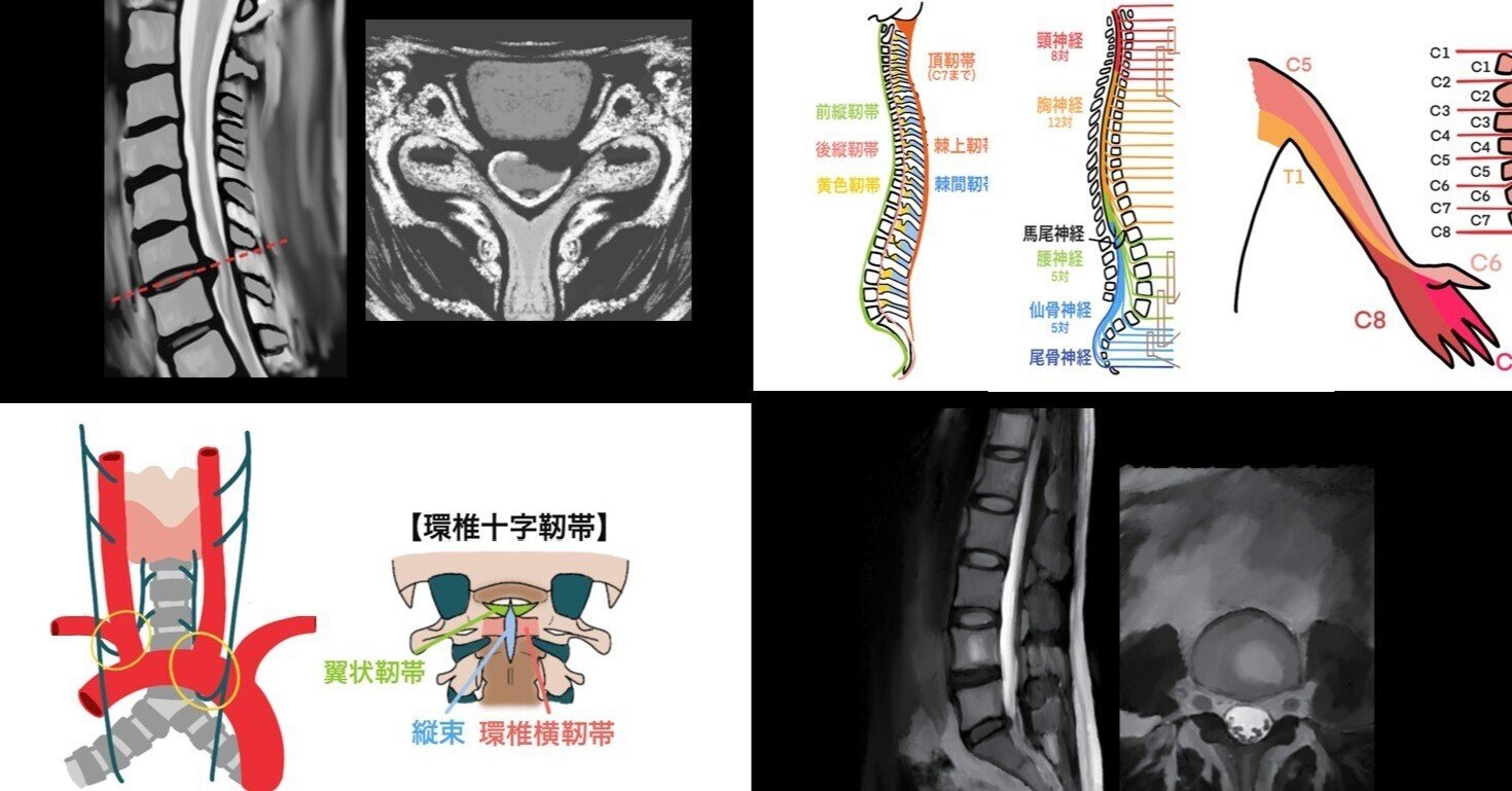 裁断済】エキスパートのための脊椎脊髄疾患のMRI 第3版