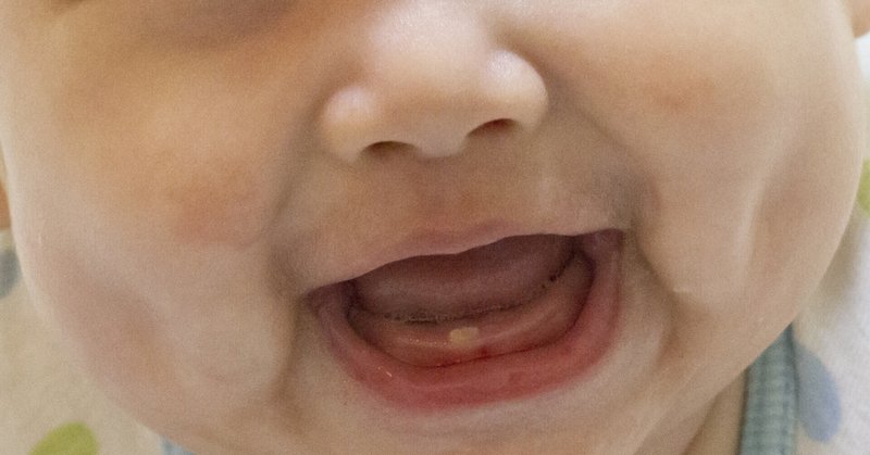 [小児科医ママが解説] おうちで健診：歯が生えてこない。歯の生え方が気になる。歯みがきのフッ素はどうしたらいい？