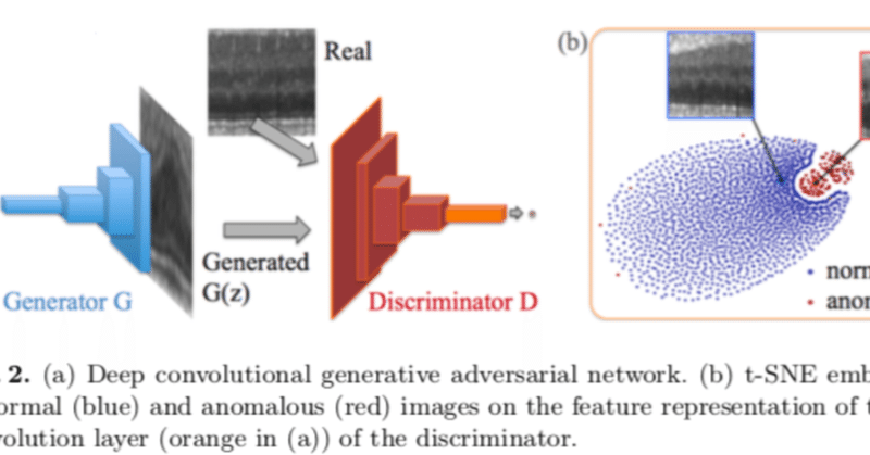 異常検知とGANのまとめ(ベースとなっている論文のおさらい)