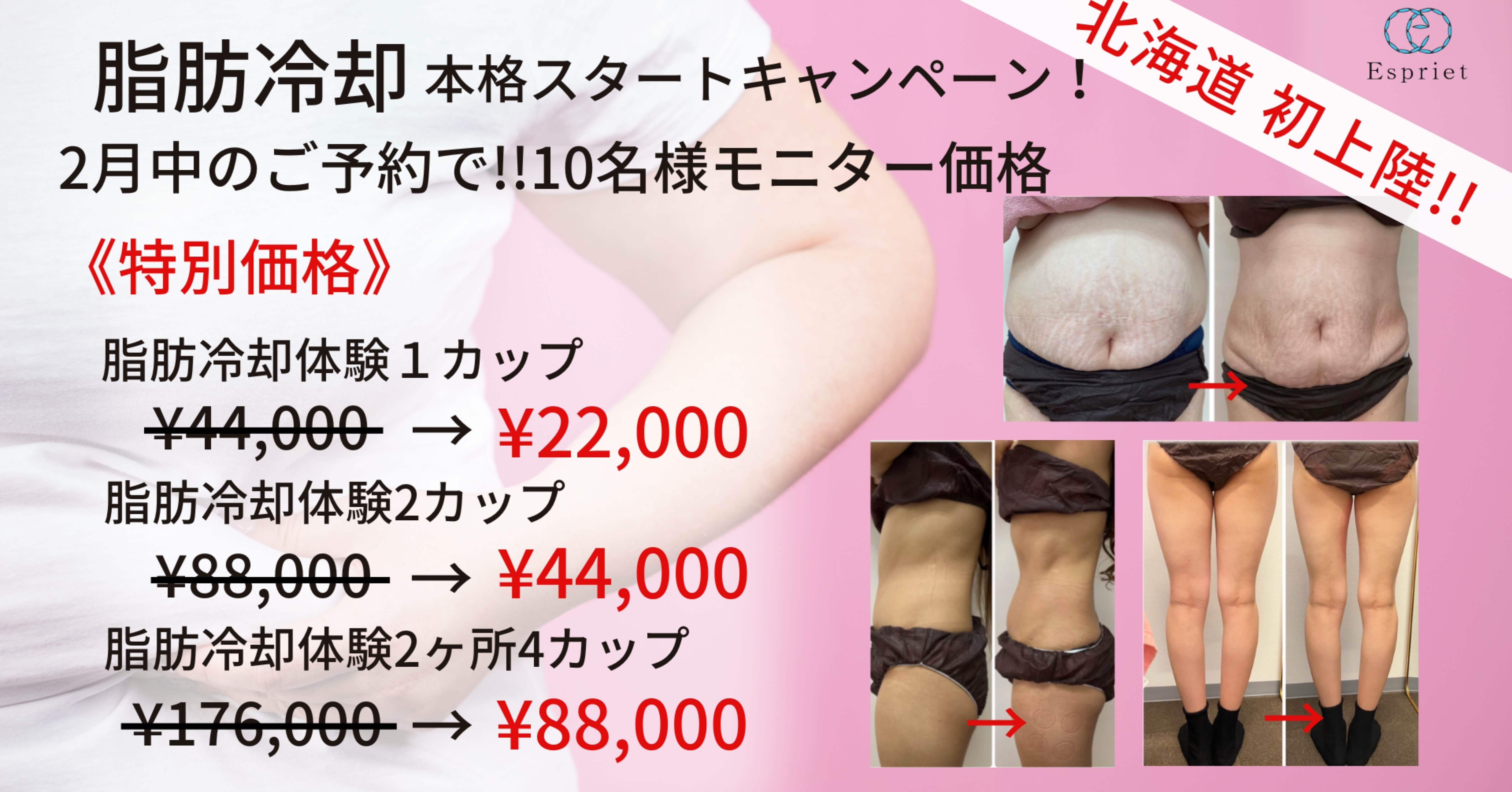 脂肪冷却キャンペーン