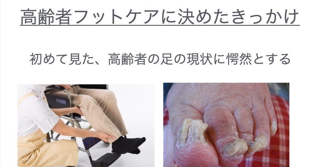 高齢者フットケア始めたきっかけ｜高齢者の「自分らしく」を足から支え
