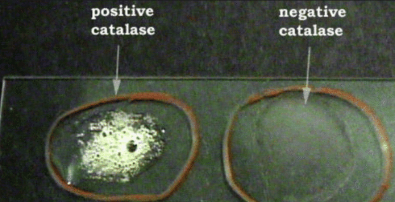 カタラーゼ試験は過酸化水素水の触媒反応 森永 康平 ミルキク Note
