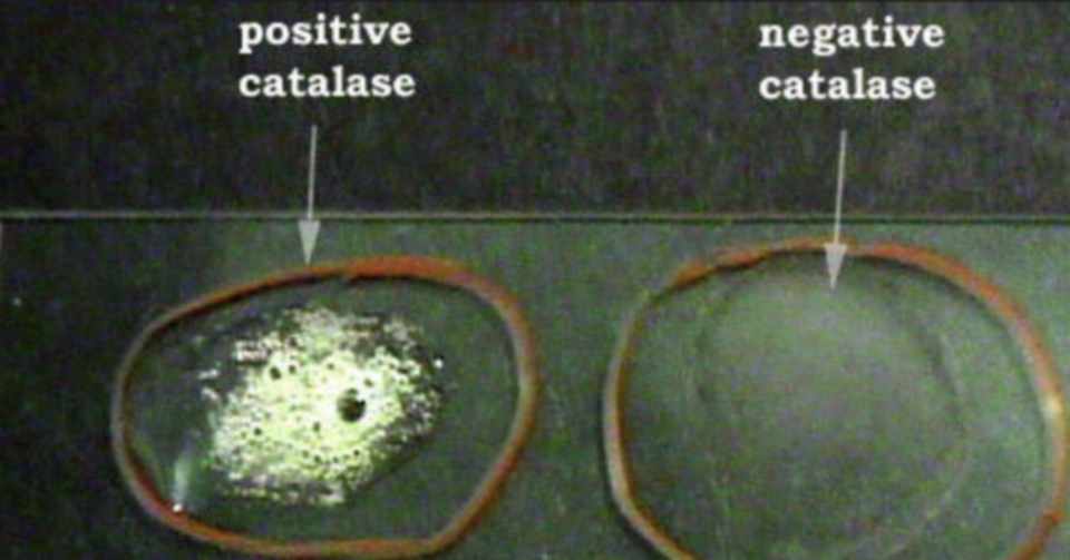 カタラーゼ試験は過酸化水素水の触媒反応 ミルキク Note